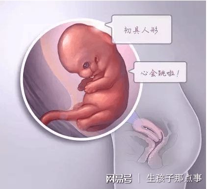 高齢初産